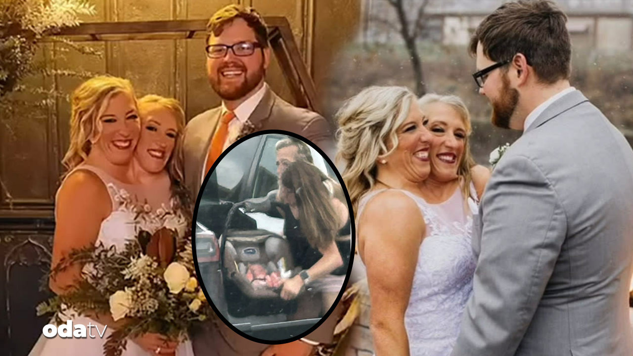 yapisik ikizler bebek sahibi oldu vg6USjRi